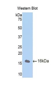 CUBN / Cubilin Antibody (aa3511-3623)