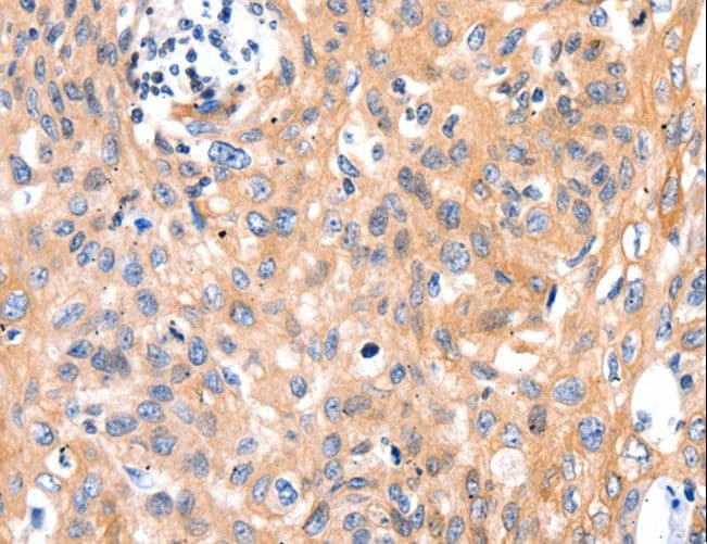 MLC2 / MYL9 Antibody