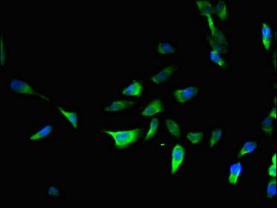 Polyclonal Rabbit anti-Human PRRG3 / TMG3 Antibody