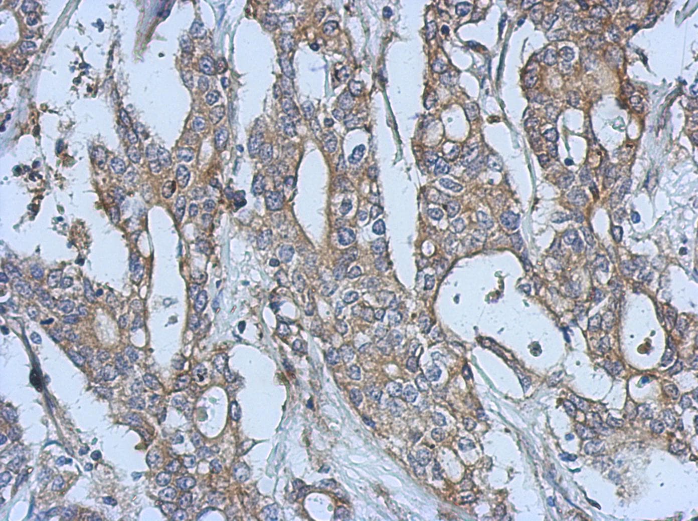 EPHA3 / EPH Receptor A3 Antibody