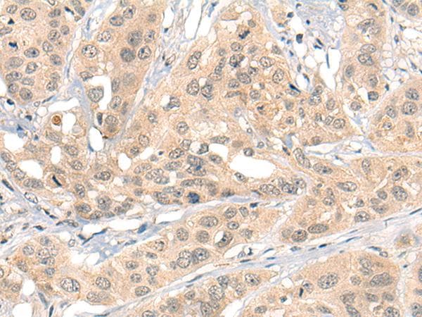 Polyclonal Rabbit anti-Human HIPK2 Antibody (IHC, WB)