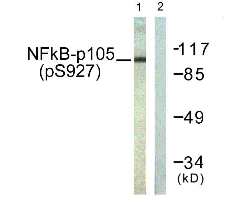 NFKB1 / NF-Kappa-B Antibody (phospho-Ser927)