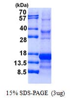 Human INHA / Inhibin Alpha Protein (Recombinant His)
