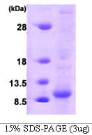 Human GLRX / Glutaredoxin Protein (Recombinant)