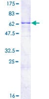 Human PRKCDBP / CAVIN3 Protein (Recombinant GST)