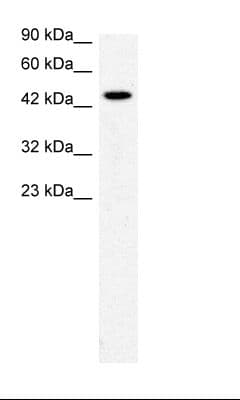 Polyclonal Rabbit anti-Human SLC17A2 Antibody (aa230-279, IHC, WB)