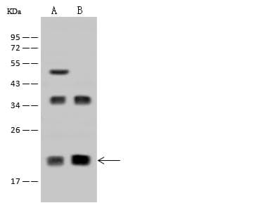 DR1 / NC2 Antibody