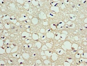 Polyclonal Rabbit anti-Human CA8 / Carbonic Anhydrase VIII Antibody (aa1-290, IHC, WB)