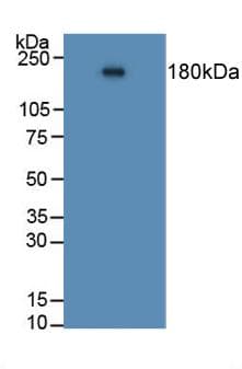 ACE / CD143 Antibody (aa814-1071)