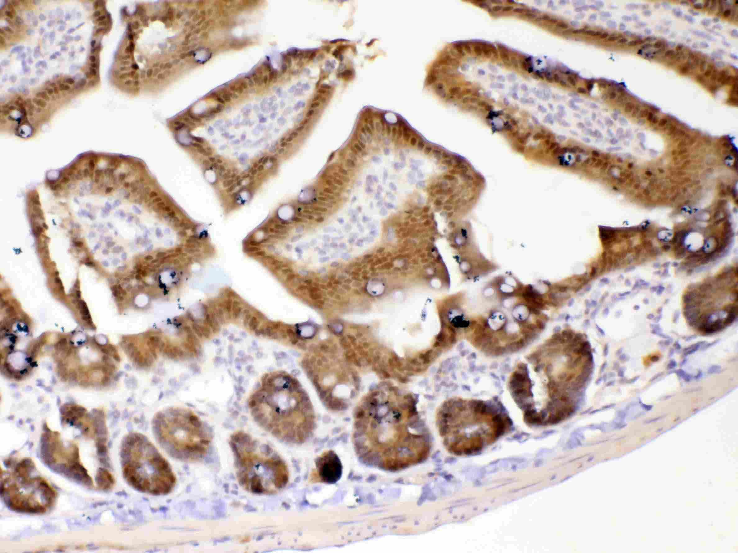 GALE / UDP-Glucose 4-Epimerase Antibody