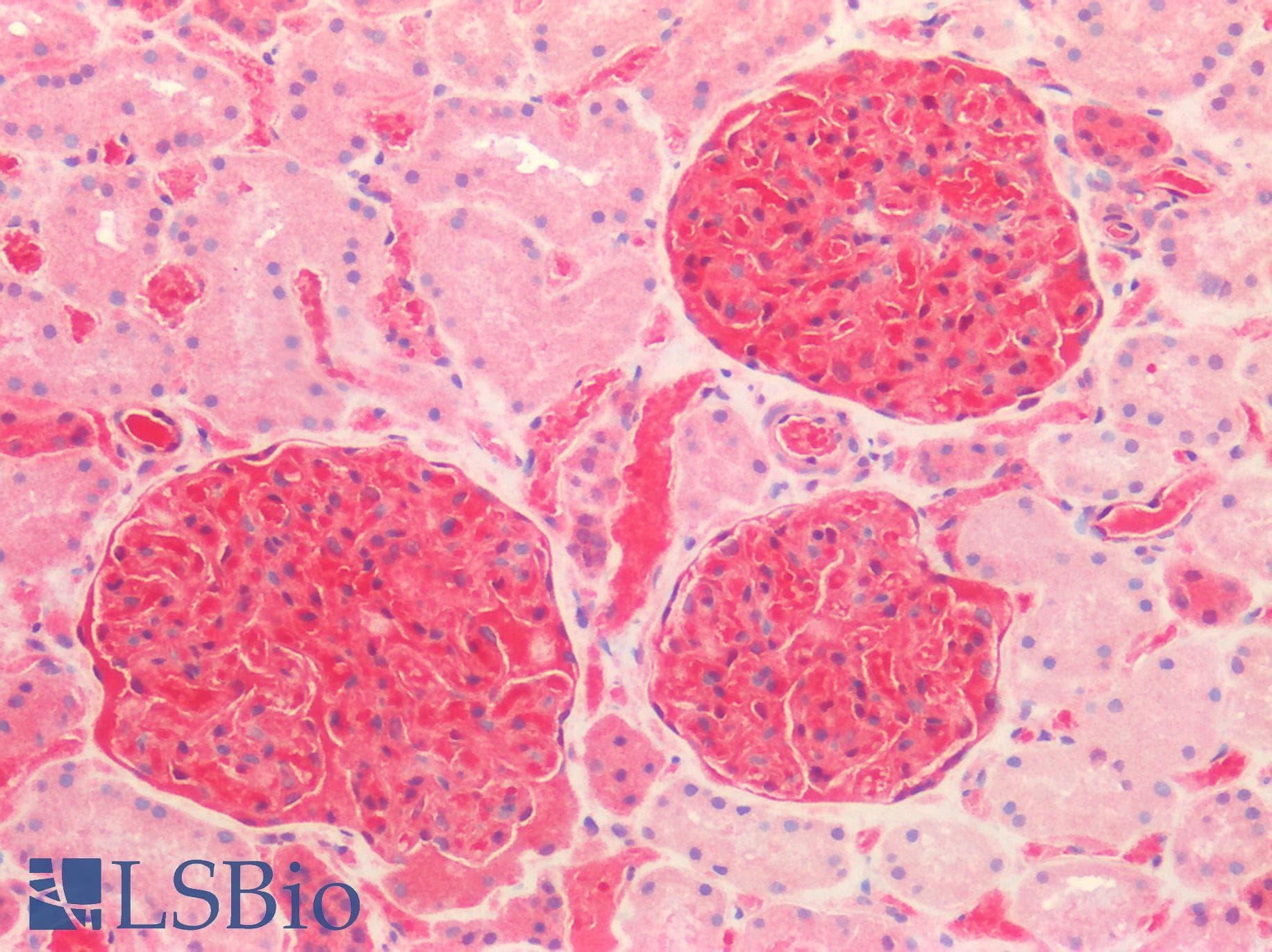 S100A6 / Calcyclin Antibody (aa1-89)