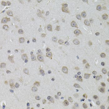 TNF Alpha Antibody