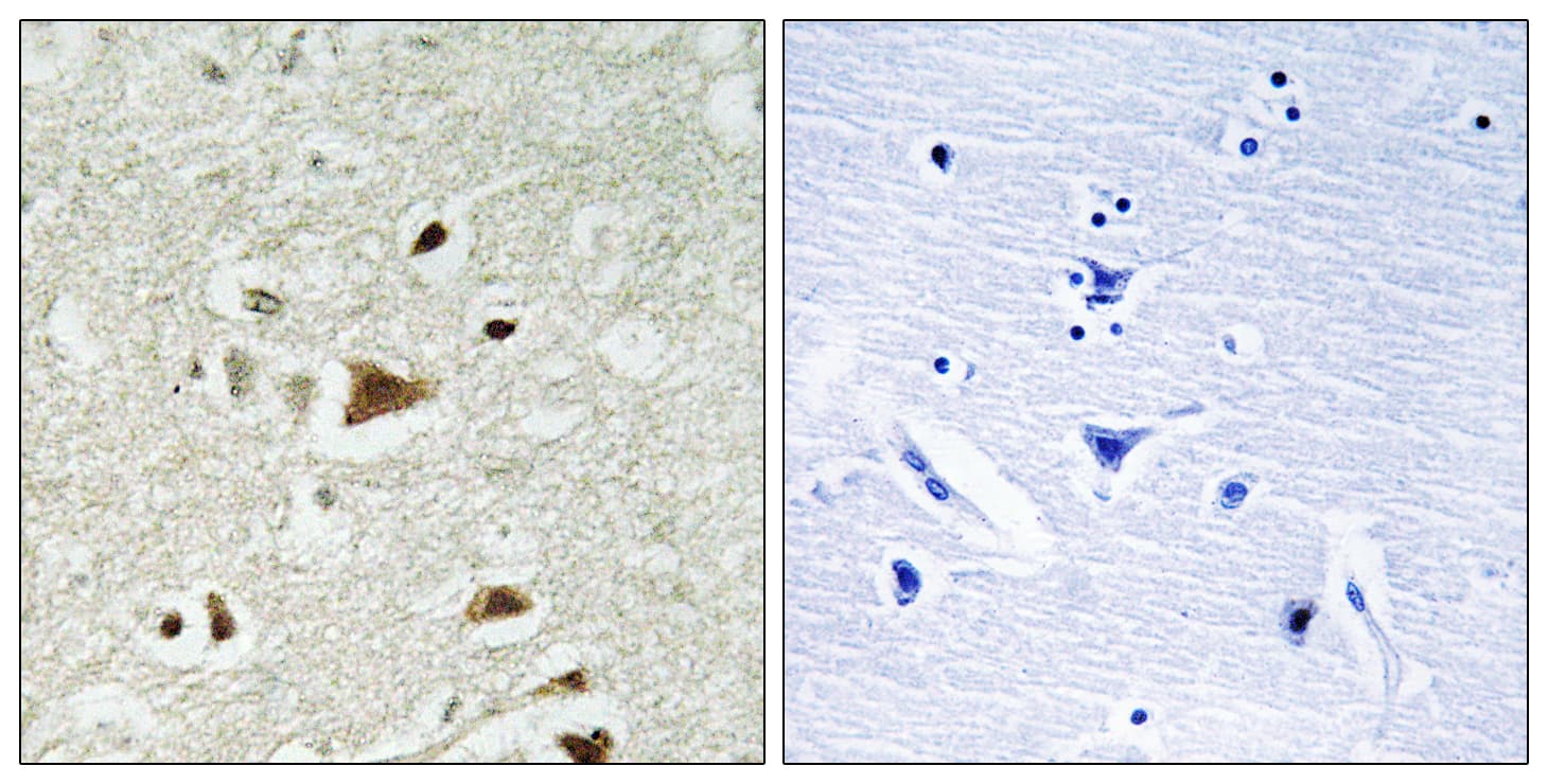 SMAD2 Antibody (aa186-235)