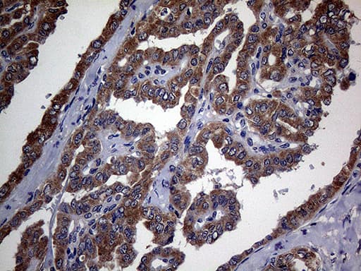TGFBR2 Antibody (aa23-294, clone OTI3B4)