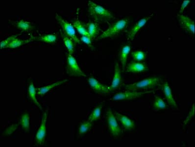 Polyclonal Rabbit anti-Human RAF1 / RAF Antibody (aa1-648)