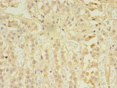 RIPK3 / RIP3 Antibody