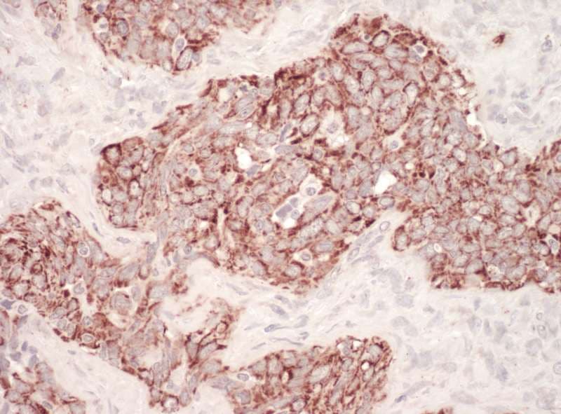 HSPD1 / HSP60 Antibody (aa250-300)