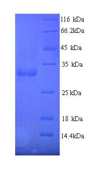 E. coli FimH Protein (Recombinant 6His, N-terminus)