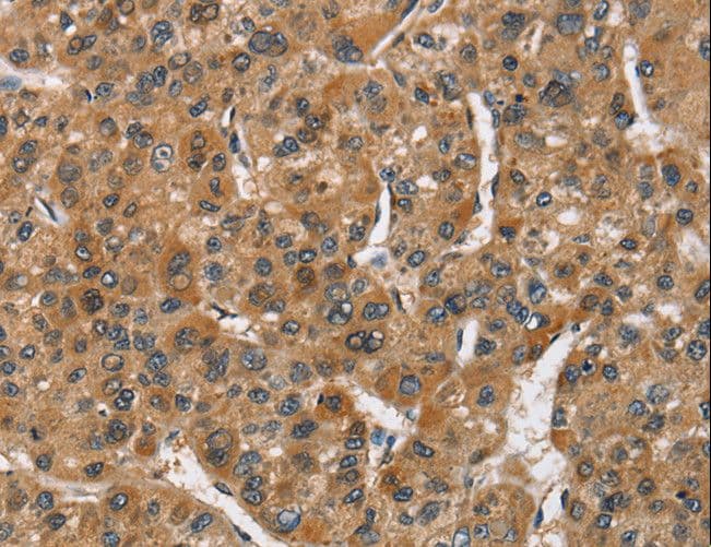 Polyclonal Rabbit anti-Human ATF4 Antibody (IHC)