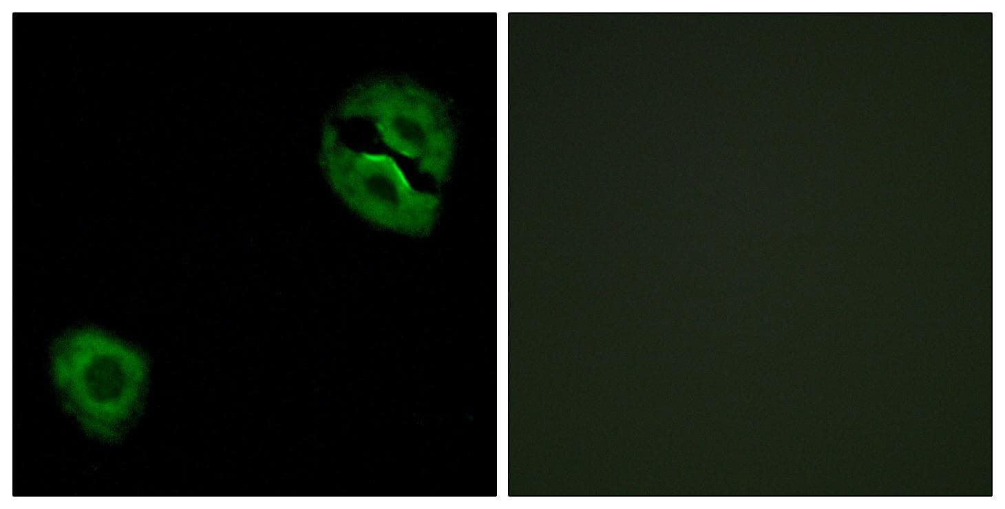 Polyclonal Rabbit anti-Human COL19A1 / Collagen XIX Antibody (IHC, IF)