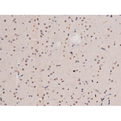 ADD1 / Adducin Alpha Antibody (phospho-Ser726)