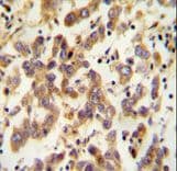 C20orf173 Antibody (aa48-76)
