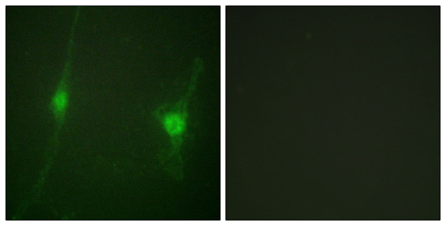 STK11 / LKB1 Antibody (aa384-433)