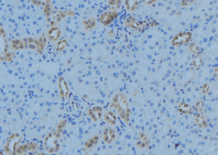 Polyclonal Rabbit anti-Human ACOT9 Antibody (IHC, WB)