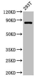 IHC-plus™ CAPN2 / Calpain 2 / M-Calpain Antibody