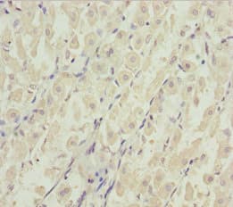 DDX11 / CHLR1 Antibody