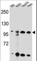 KSR2 Antibody (aa603-638)