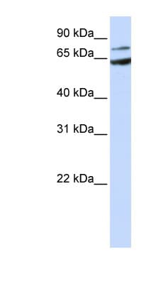 FZD8 / Frizzled 8 Antibody (aa144-193)