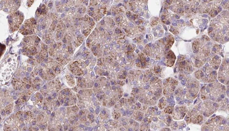 Polyclonal Rabbit anti-Human NCKAP1 / NAP125 Antibody (IHC, WB)