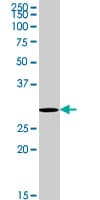Monoclonal Mouse anti-Human RNF2 / RING2 / RING1B Antibody (clone 2B4, WB)