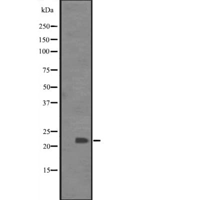 BCL7C Antibody