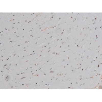 Polyclonal Rabbit anti-Human LYN Antibody (phospho-Tyr508, IHC, IF, WB)