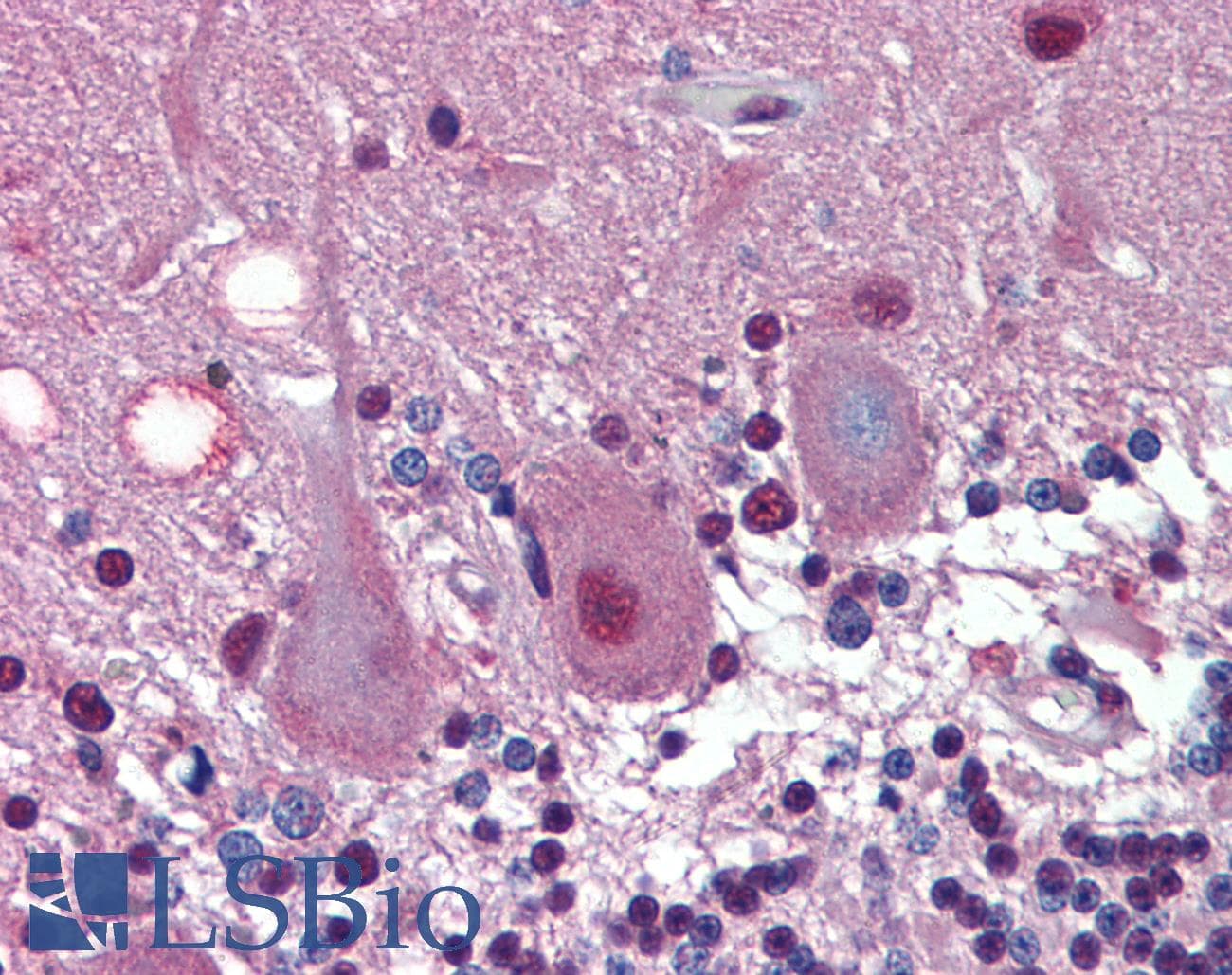 IHC-plus™ Monoclonal Mouse anti-Human HDAC3 Antibody (clone 3A7B5, aa224-428, IHC, WB)