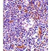 Polyclonal Rabbit anti-Human NKIRAS1 Antibody (IHC, WB)