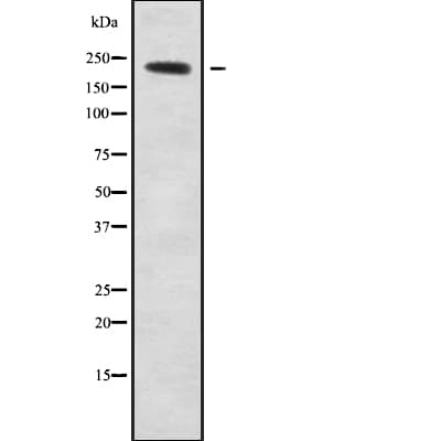 Polyclonal Rabbit anti-Human NAV1 Antibody (WB)