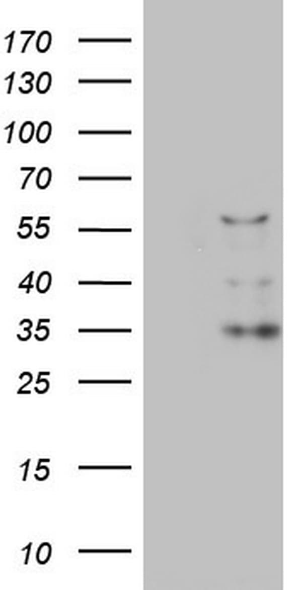 CFLAR / FLIP Antibody (aa1-272, clone OTI2H3)
