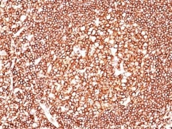 CD45 / LCA Antibody (clone 135-4C5)