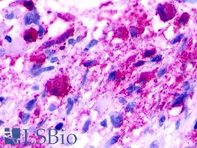 PathPlus™ Polyclonal Rabbit anti-Human NMUR1 Antibody (C-Terminus, IHC)