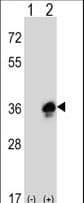 MPZ / P0 Antibody (aa186-215)