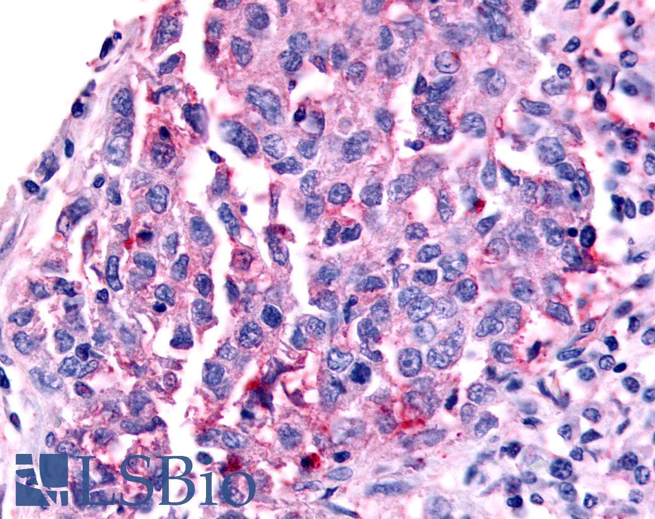 PathPlus™ Polyclonal Rabbit anti-Human NR0B2 Antibody (Ligand-binding Domain, IHC, IF)