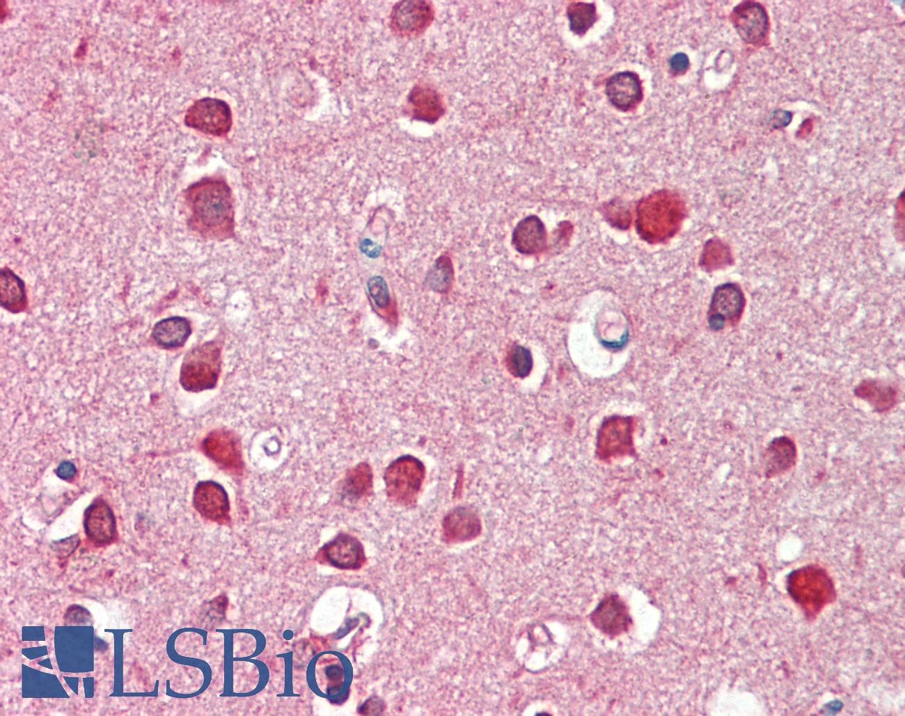 IHC-plus™ Monoclonal Mouse anti-Human GBX2 Antibody (aa103-131, IHC, WB)
