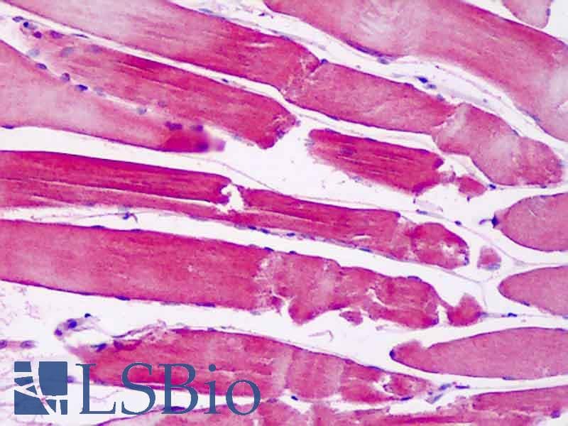 IHC-plus™ PAK6 Antibody (aa268-297)