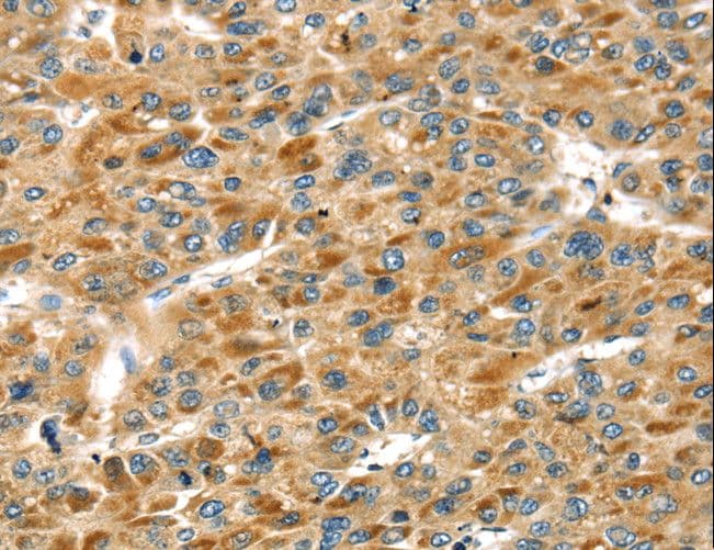 Polyclonal Rabbit anti-Human STX11 / Syntaxin 11 Antibody (IHC, WB)
