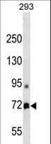 MTA1 Antibody (aa659-687)