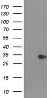 HDHD2 Antibody (clone OTI2E11)