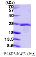Human EIF3K Protein (Recombinant His)